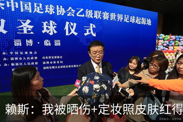 赖斯：我被晒伤+定妆照皮肤红得发亮，我妈快把我骂死了